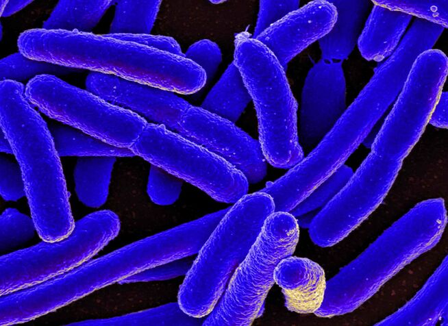 E. coli көбінесе әйелдерде циститтің дамуын қоздырады